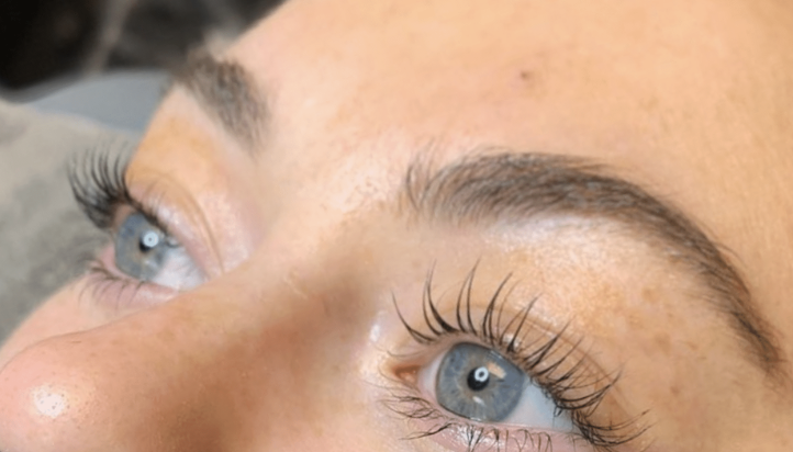 Close-up of a woman's face focusing on her enhanced eyebrows after a treatment.