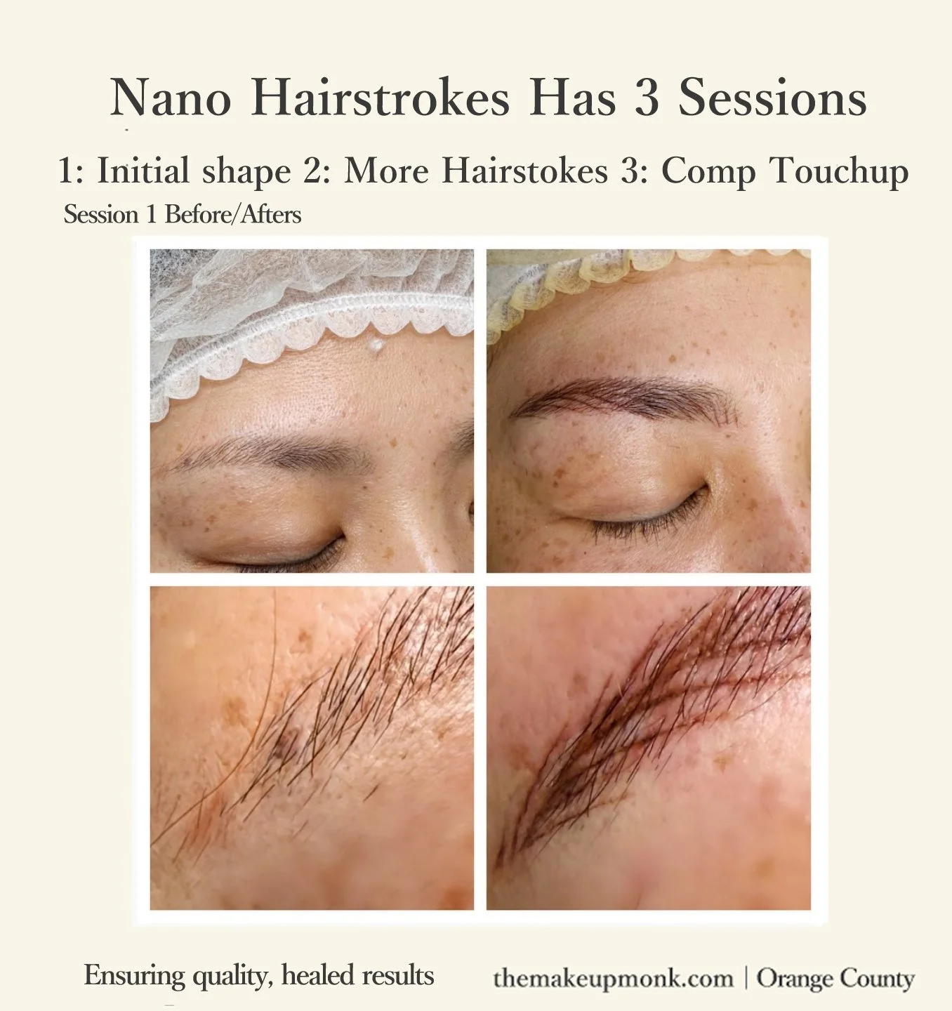 Why Nano Hairstrokes Take 3 Sessions

Nano hairstrokes are built slowly for the most natural result.

&bull; Session 1: Create the main shape and foundational hairstrokes
&bull; Session 2: Add density and balance after healing
&bull; Session 3: Compl