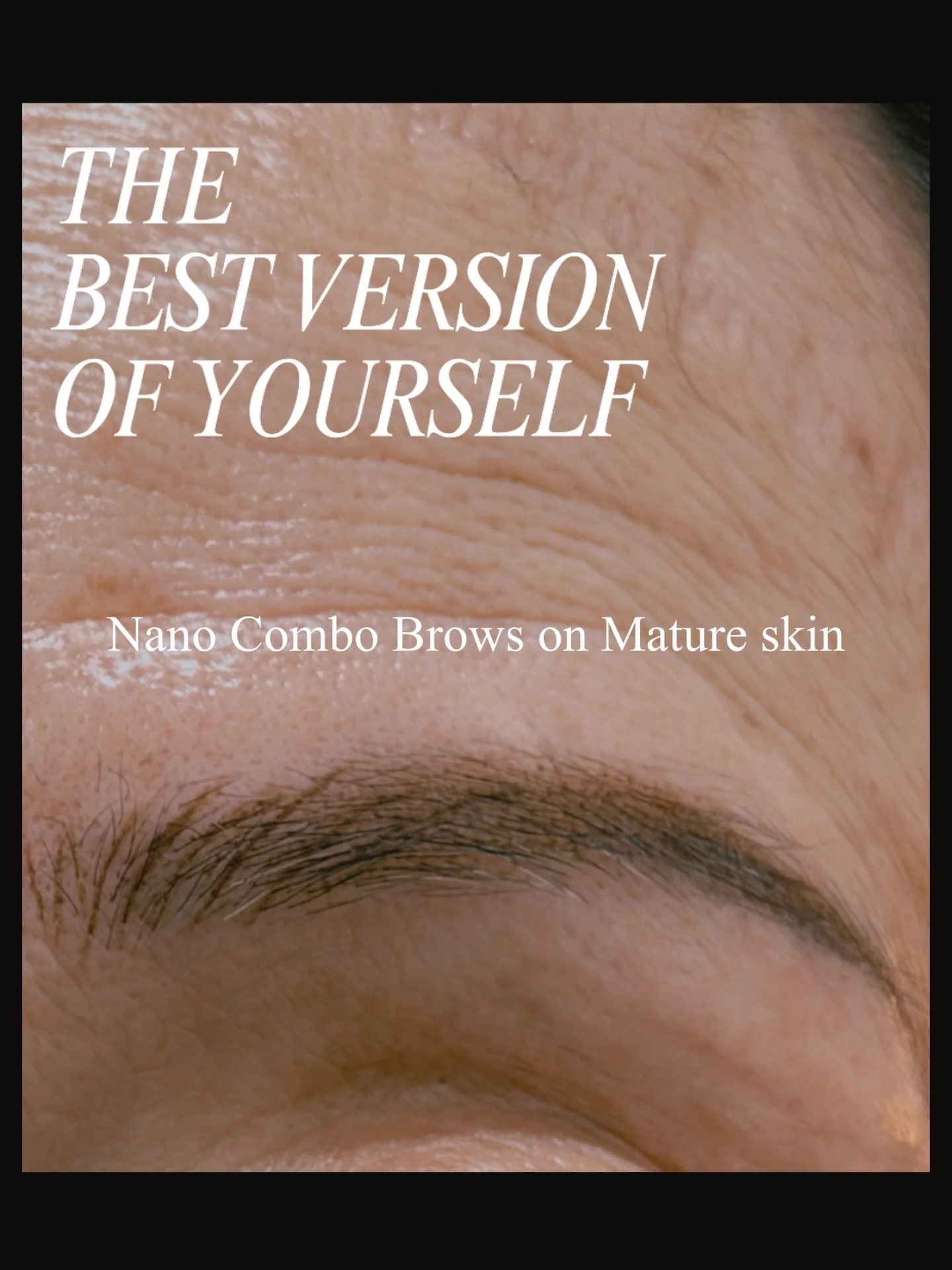 Regain, Refresh, Rejuvenate!
Reclaim yourself, and wake up with no Makeup.

This lovely woman for 30+ years never knew she was given a brow tattoo, previously. When she came in with her daughter to translate, we were all in for a shock!!⚡️ For years 