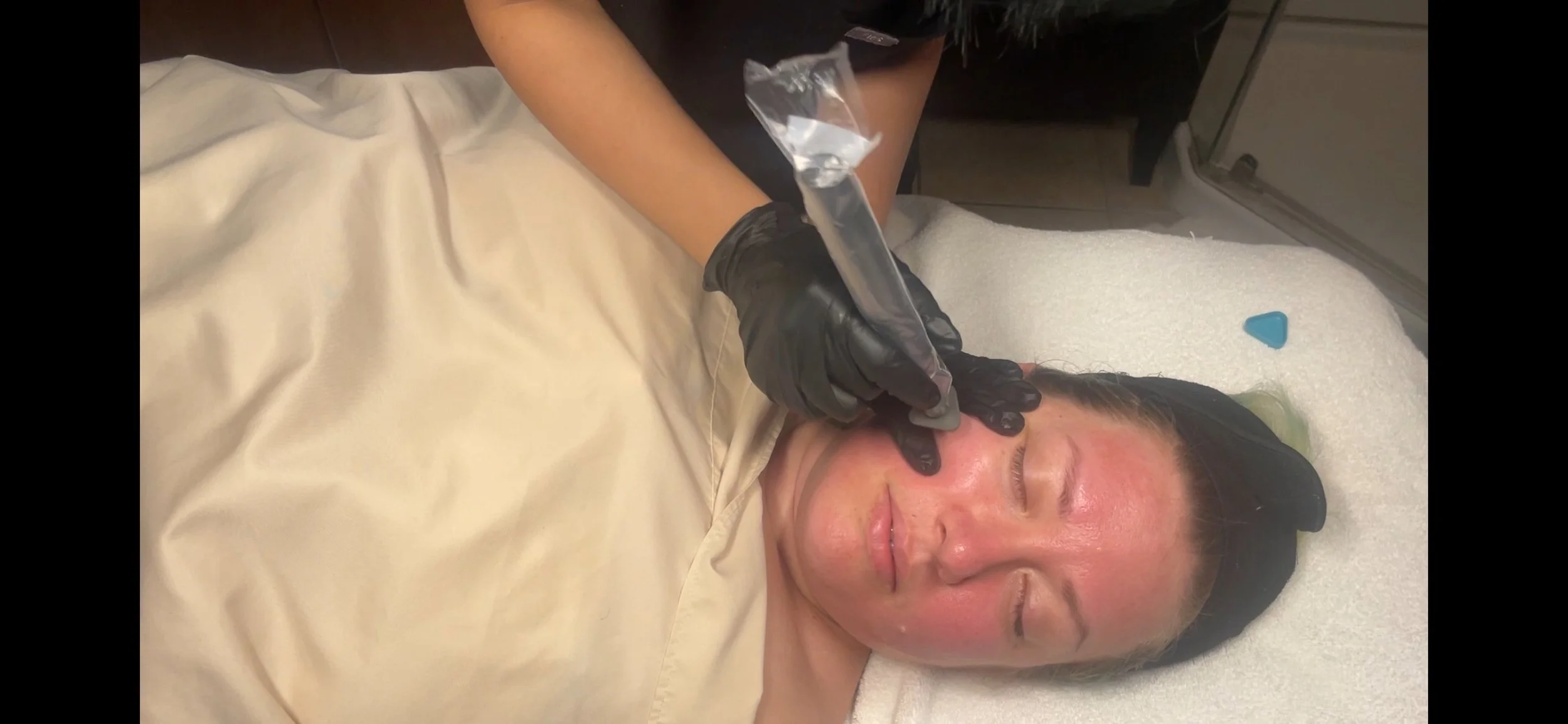 MicroChanneling Session