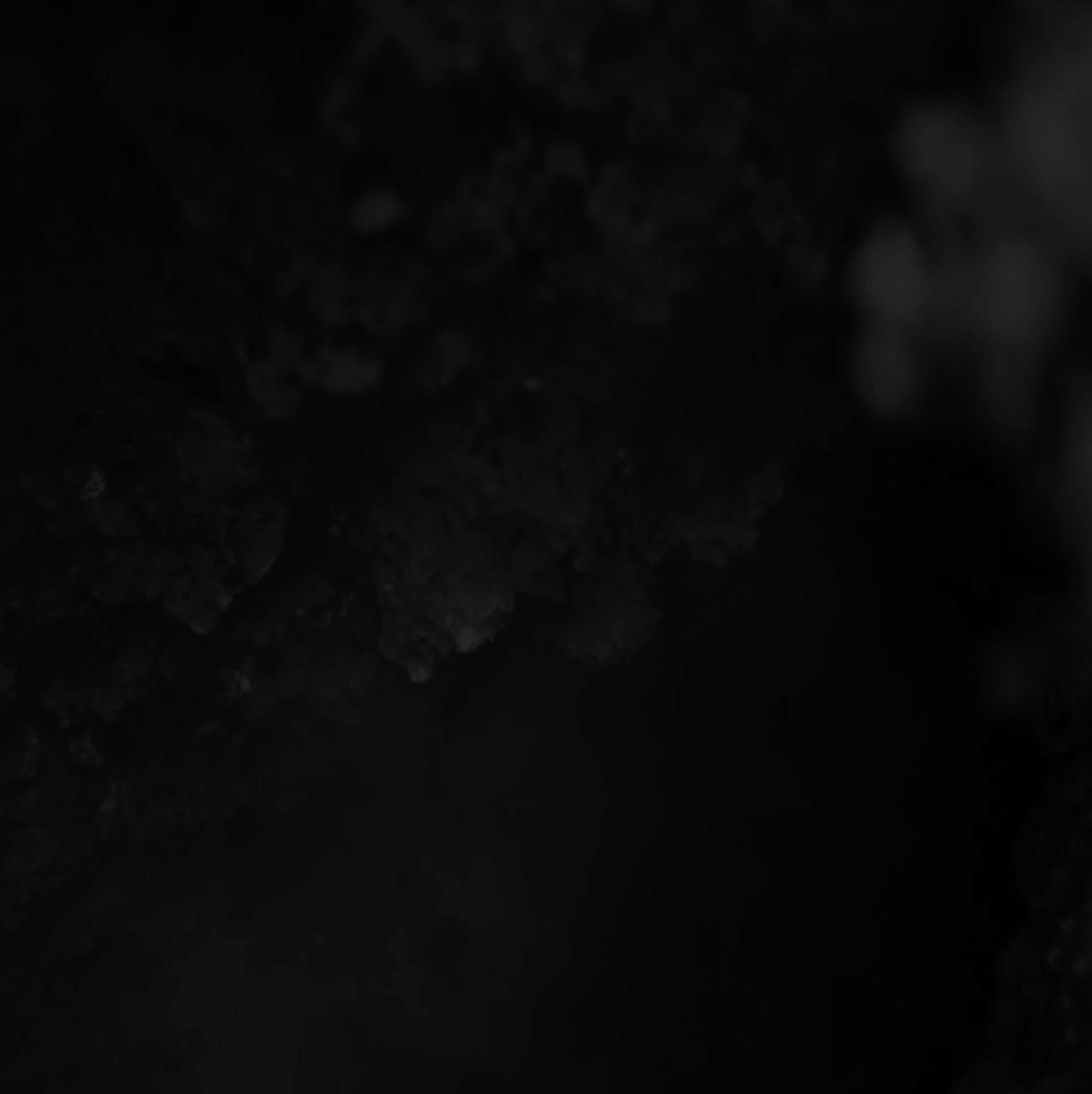 Very dark image with unclear details.