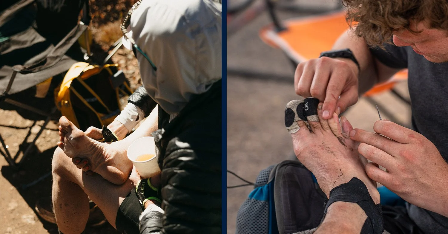 Two runners examine their feet and get held with bandaging blisters
