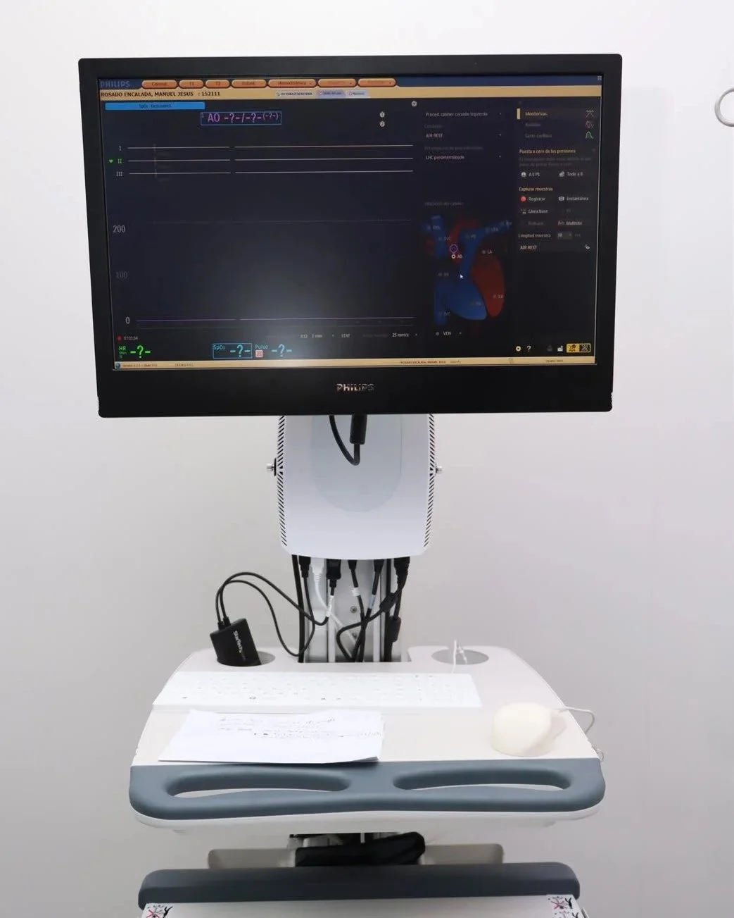  La Azurion 7, tecnología de punta con IA, coloca a Mérida a la altura de los grandes centros médicos del mundo. 