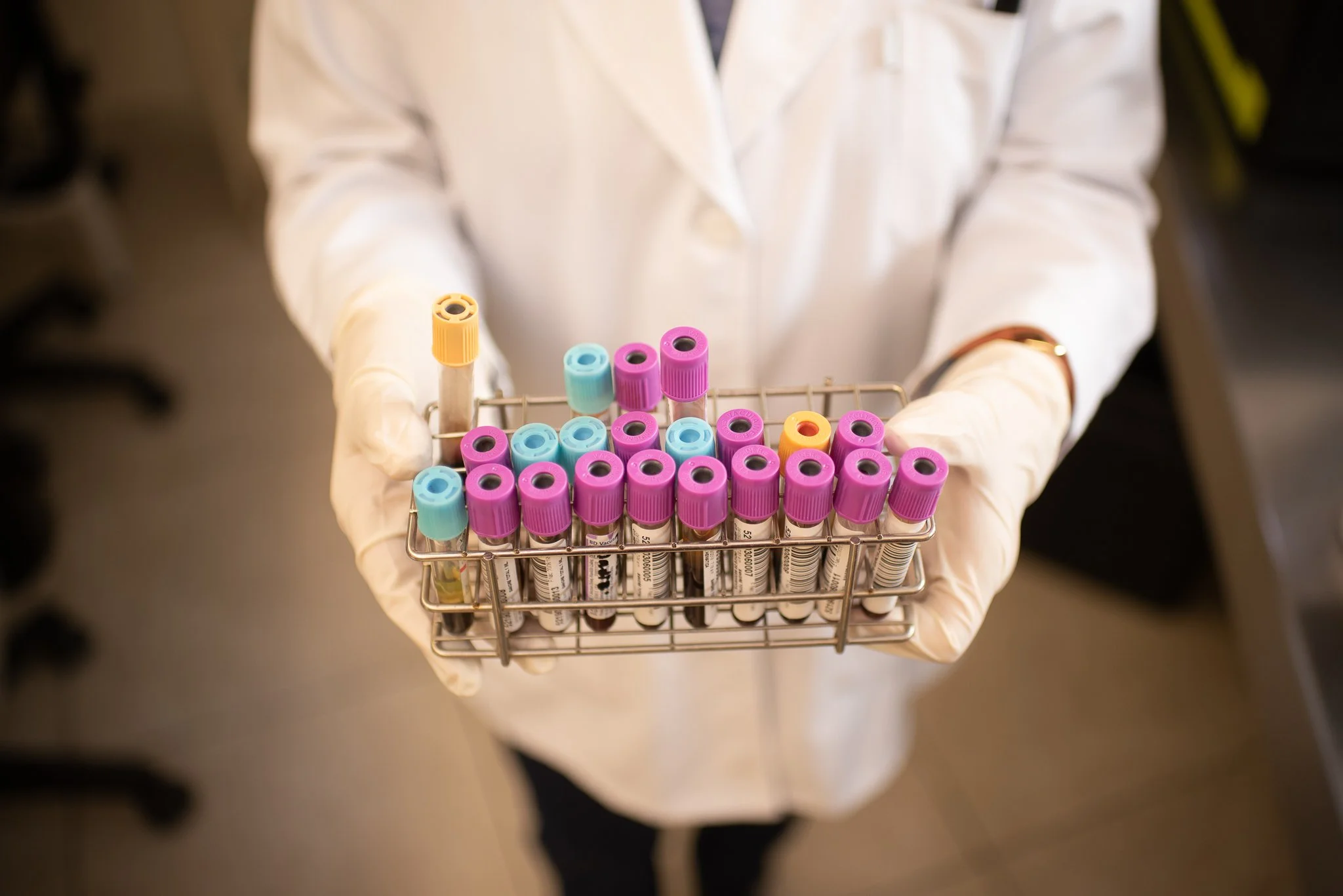 Pruebas de hepatitis en Mérida