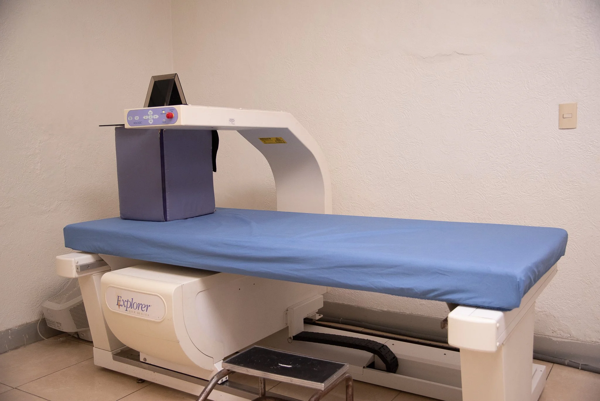 Densitometría ósea en Mérida