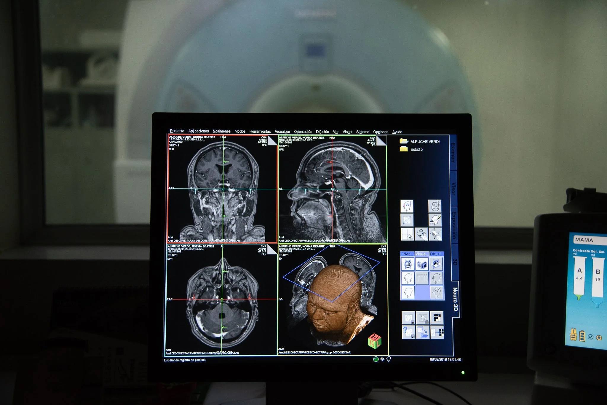Resonancias magnéticas en Mérida