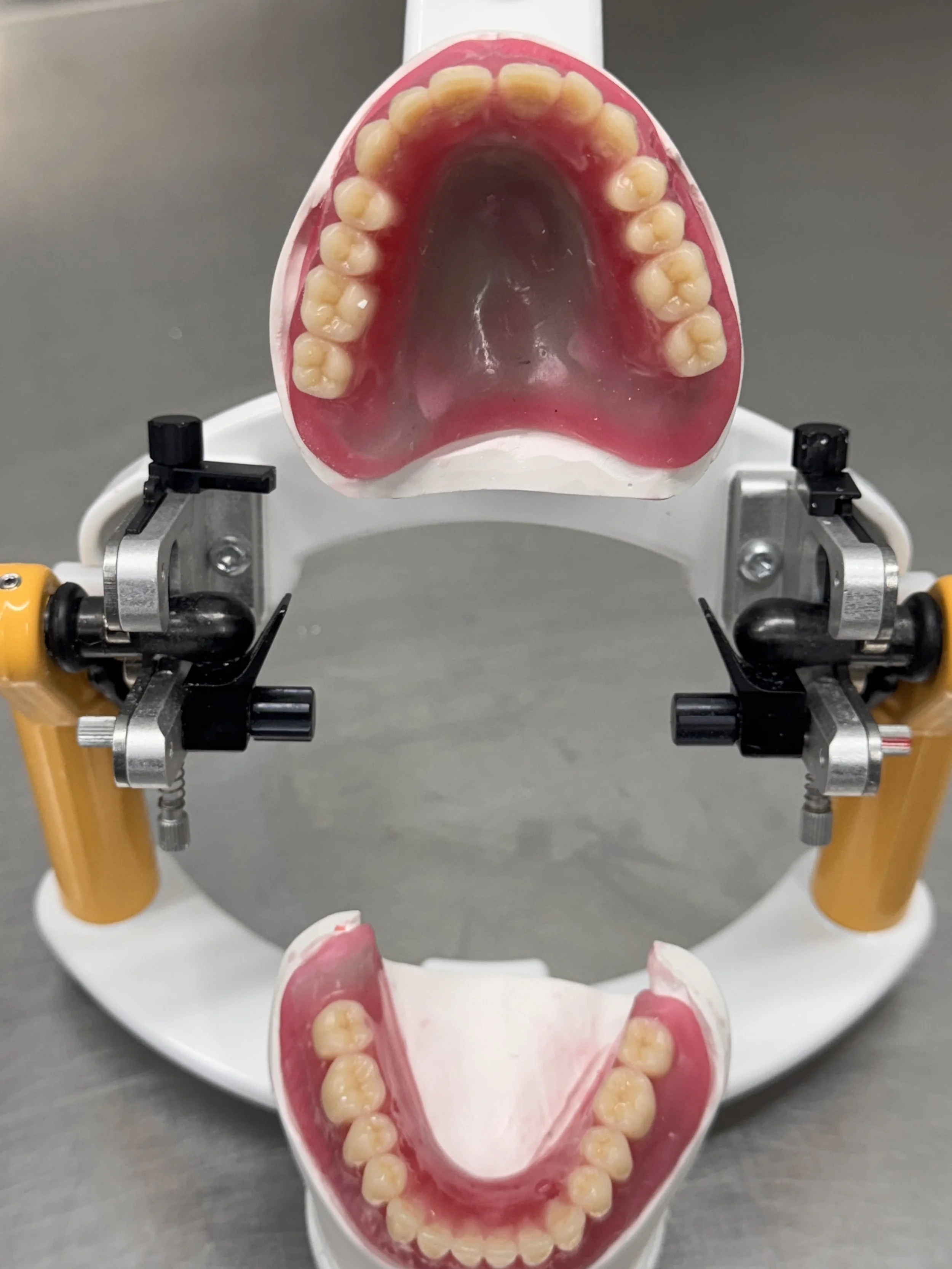 Dental model with upper and lower teeth placed on a dental articulator.