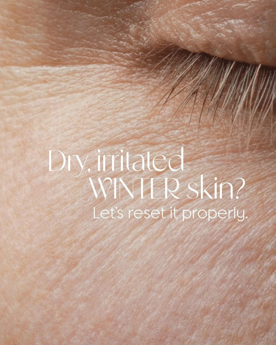 Winter isn&rsquo;t gentle on your skin &mdash; but your glow doesn&rsquo;t have to fade. At UNSEEN, December is all about restoring radiance and repairing your barrier. Ready for your winter reset? 🤎✨❄️
#unseenmedicalaesthetics #westchesteraesthetic