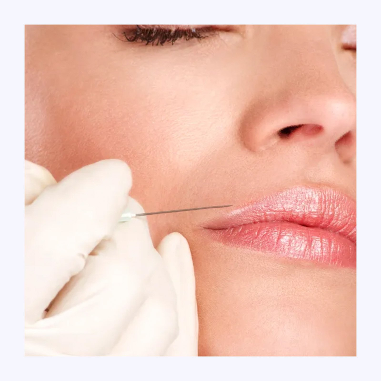 A woman receiving a cosmetic injection in her lip area from a medical professional wearing gloves.