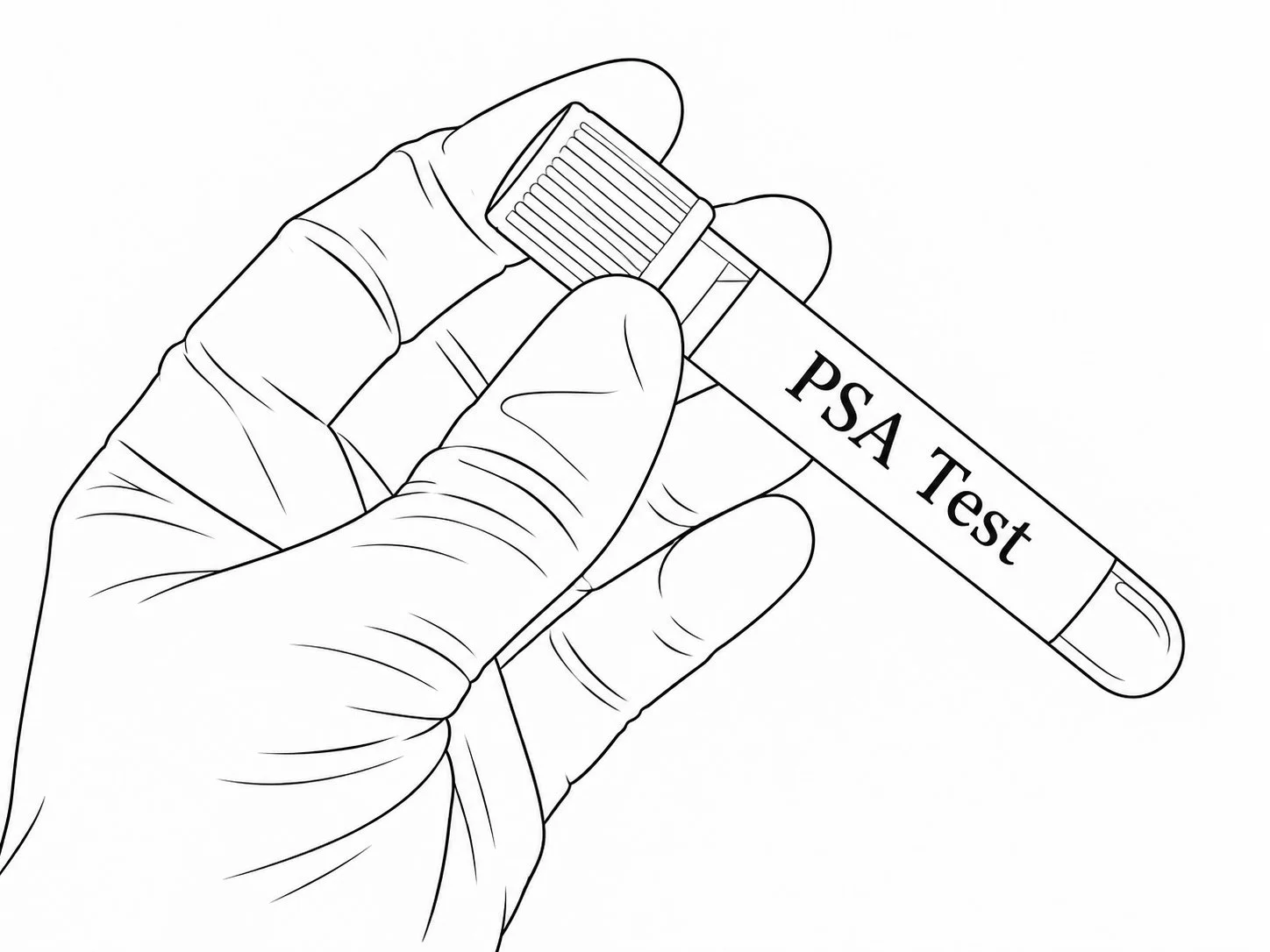 Prostate Cancer Screening