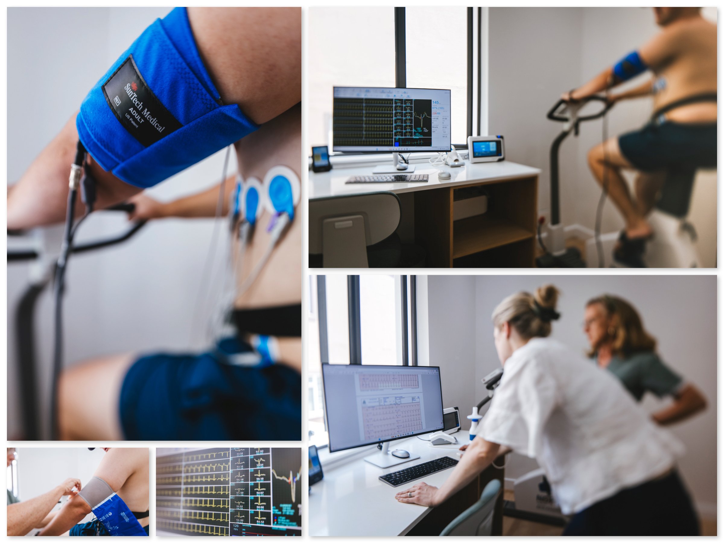 Exercise stress ECG testing at Peak Family Practice in Hout Bay, showing heart monitoring, blood pressure measurement, and real-time ECG analysis during exertion.