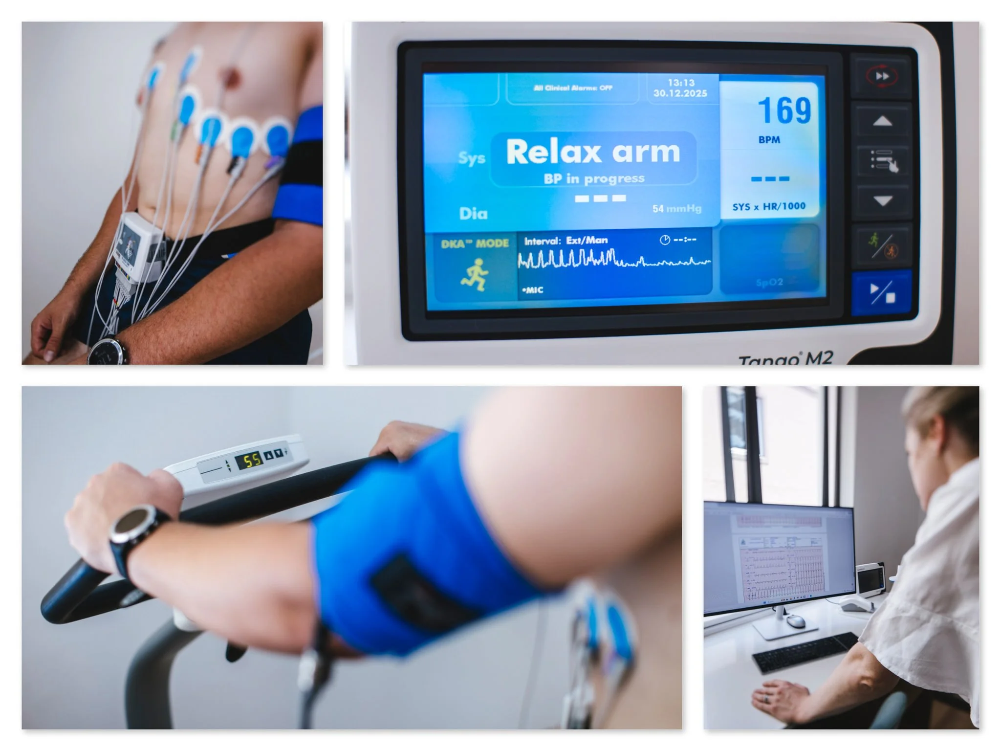 Exercise stress ECG testing at Peak Family Practice in Hout Bay, showing heart monitoring, blood pressure measurement, and ECG analysis during exertion.