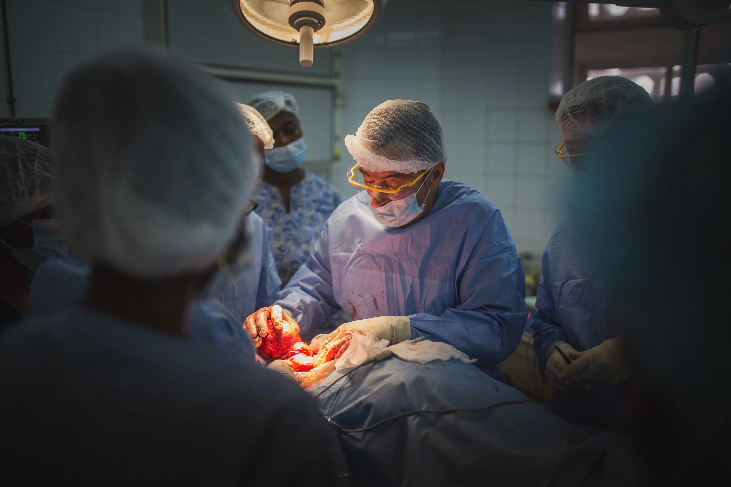 Medical team performing surgery in an operating room, with doctors and nurses focused on the procedure, wearing surgical masks, gowns, gloves, and protective eyewear.