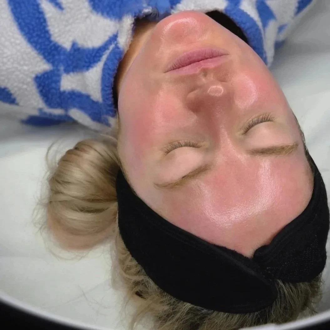 Glowing skin on a skincare client after a facial. client is lying on a treatment bed with her eyes closed under a black ring light.