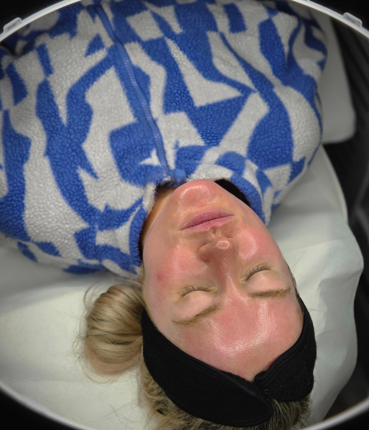 Its there anything better than that glass skin glow 💫💎 Swipe to see ➡️

Microneedling with a skin booster just hits different 🔥

Book your Glass Skin Facial through DM or booking link in bio - limited December availability 💫

#glassskinfacial #Mi