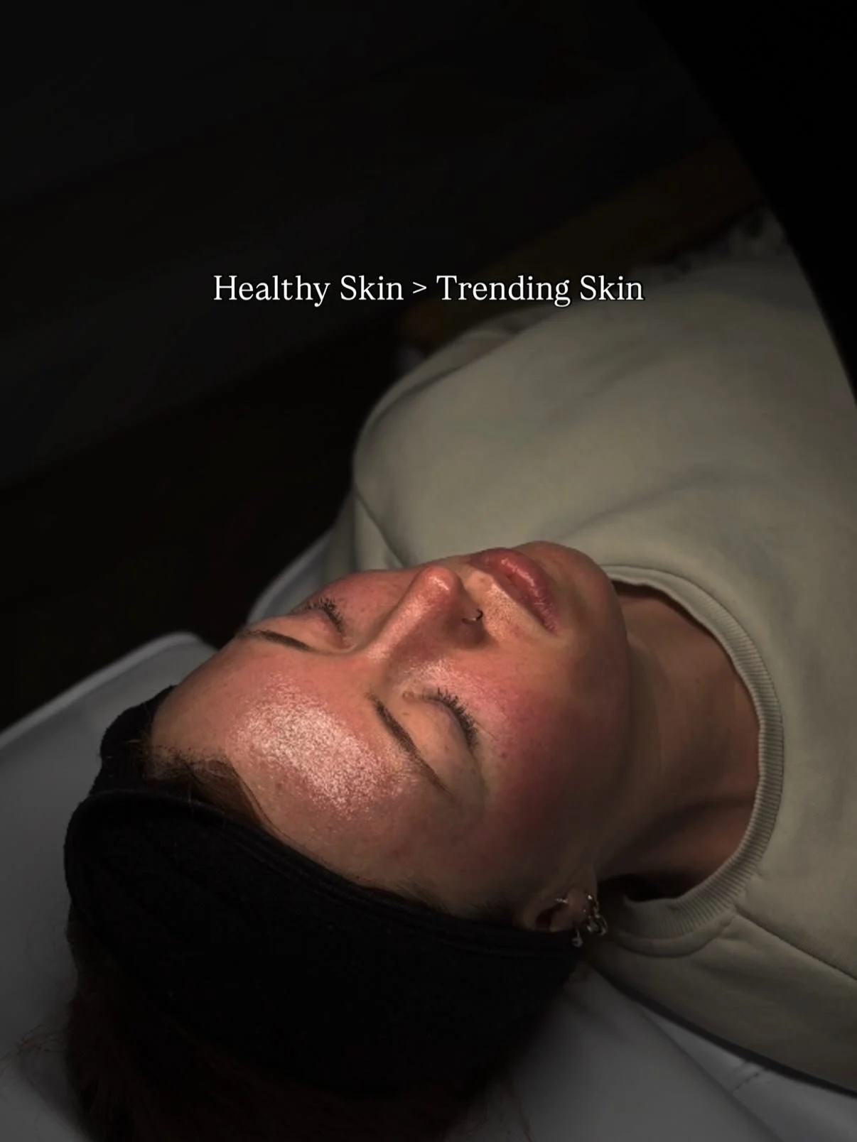 Evidence based care and healthy skin will always outlast any trend 💫

Barrier health first ✔️
Consistency over hype ✔️
Results over viral skincare ✔️

#SkinBarrier #ResultsDrivenSkincare #Skinclinic #Mullingar #Westmeath