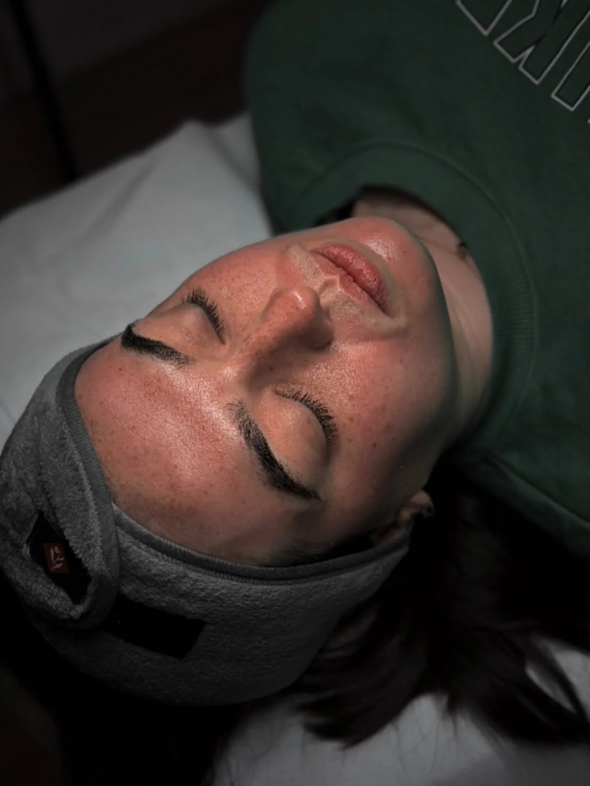 Not a reaction, a response ✨

Your skin doing exactly what it&rsquo;s meant to do after microneedling&hellip; rebuilding, repairing, working 🤍

This stage is where the real results come from.

Get in touch to have a chat about what treatments might 