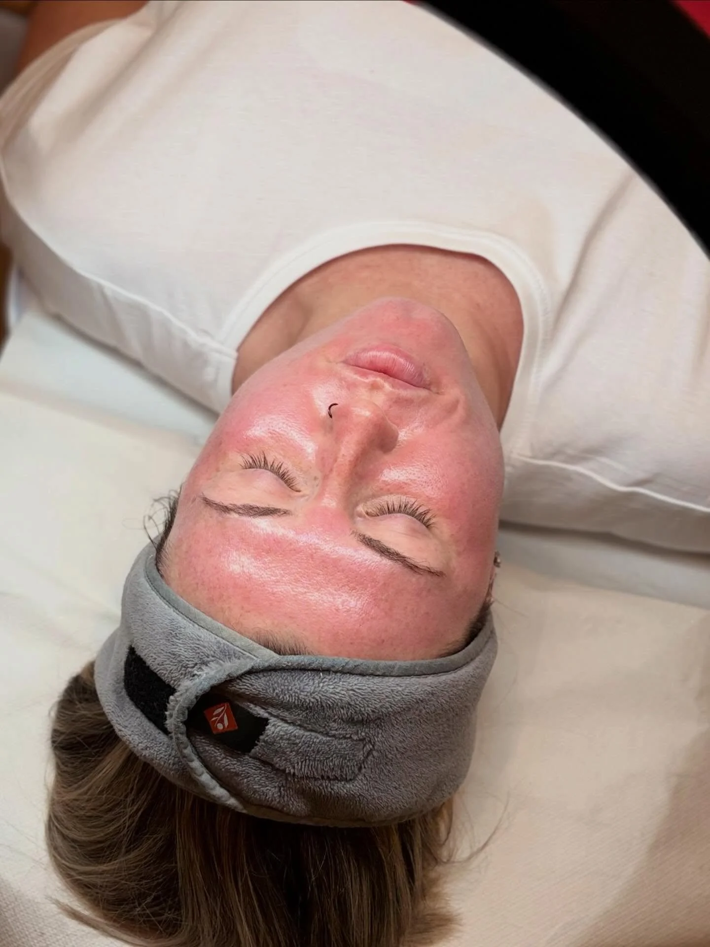 I actually couldn&rsquo;t even pick which one of these to post so here&rsquo;s all of them 😭🤣

Obsessed with the glow ✨

@tnf_wellness first Microneedling session in a while but the glow came straight back 🔥

If you were waiting for a sign to book