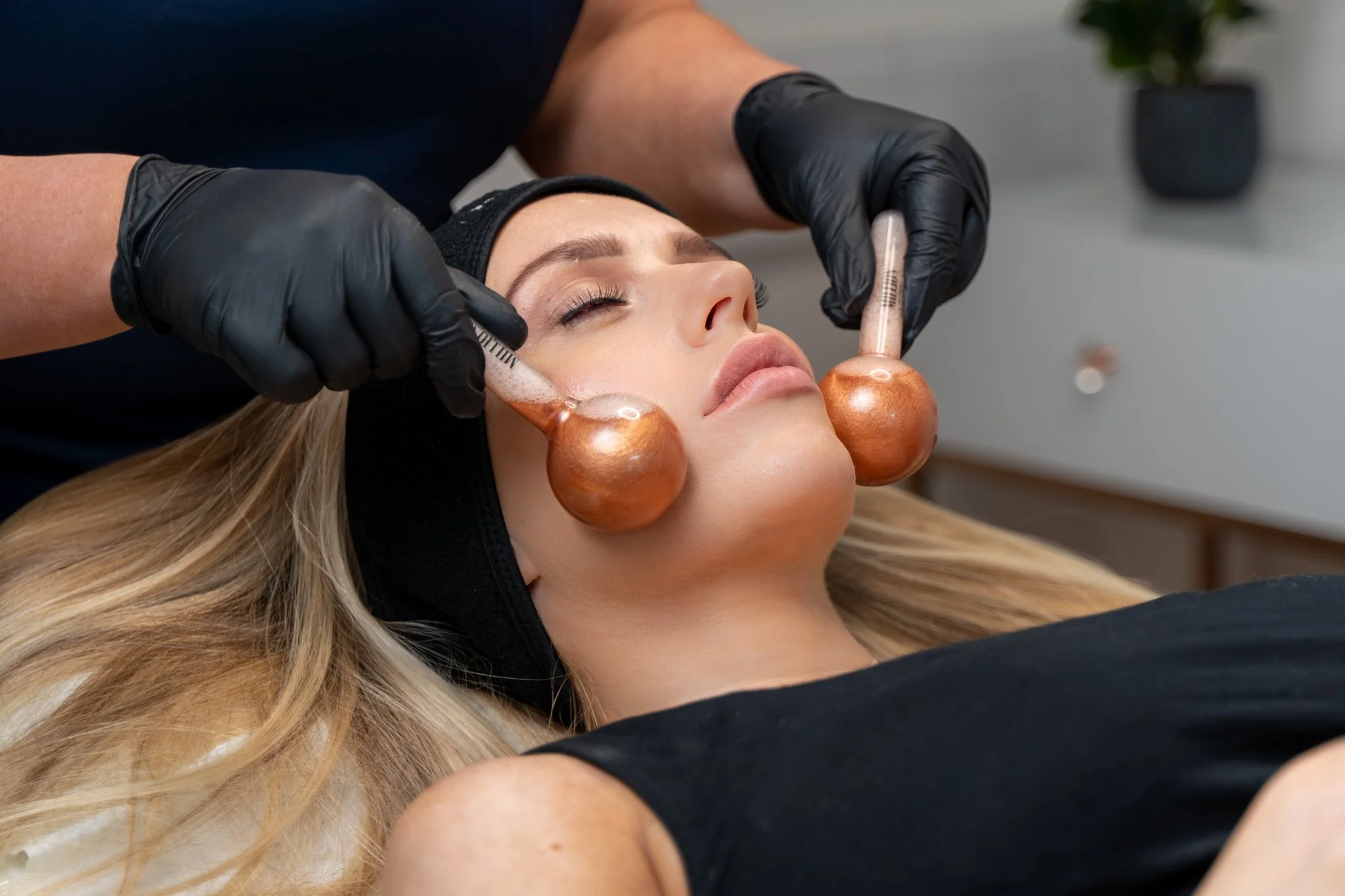 Woman receiving a facial treatment with cupping therapy using glass suction cups on her cheeks