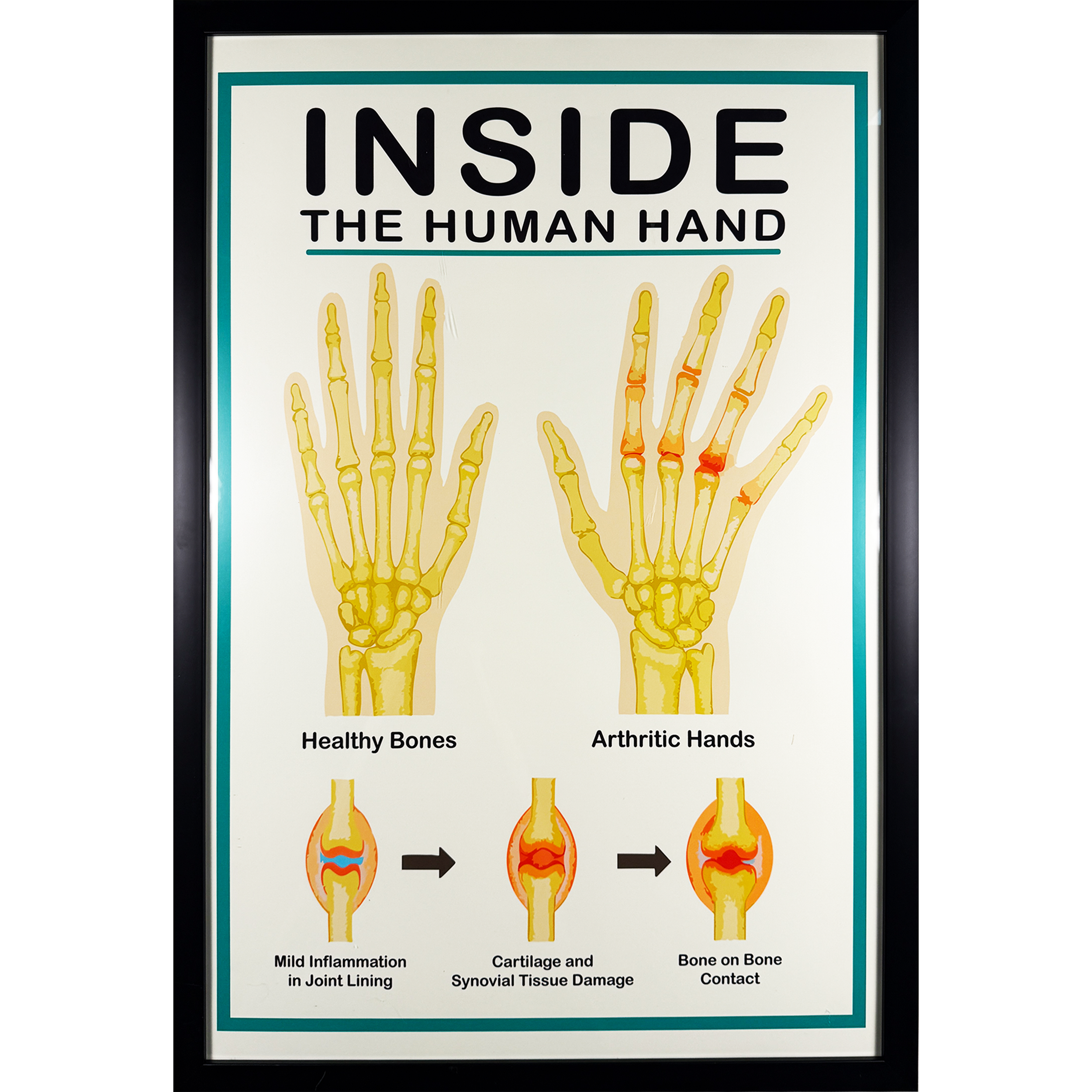 Medical Office Poster - Hands - 21.5"w x 31.5"h