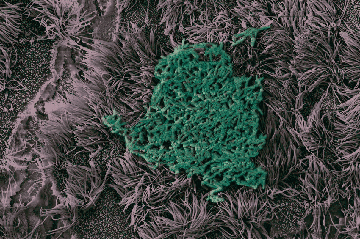Biofilms 11