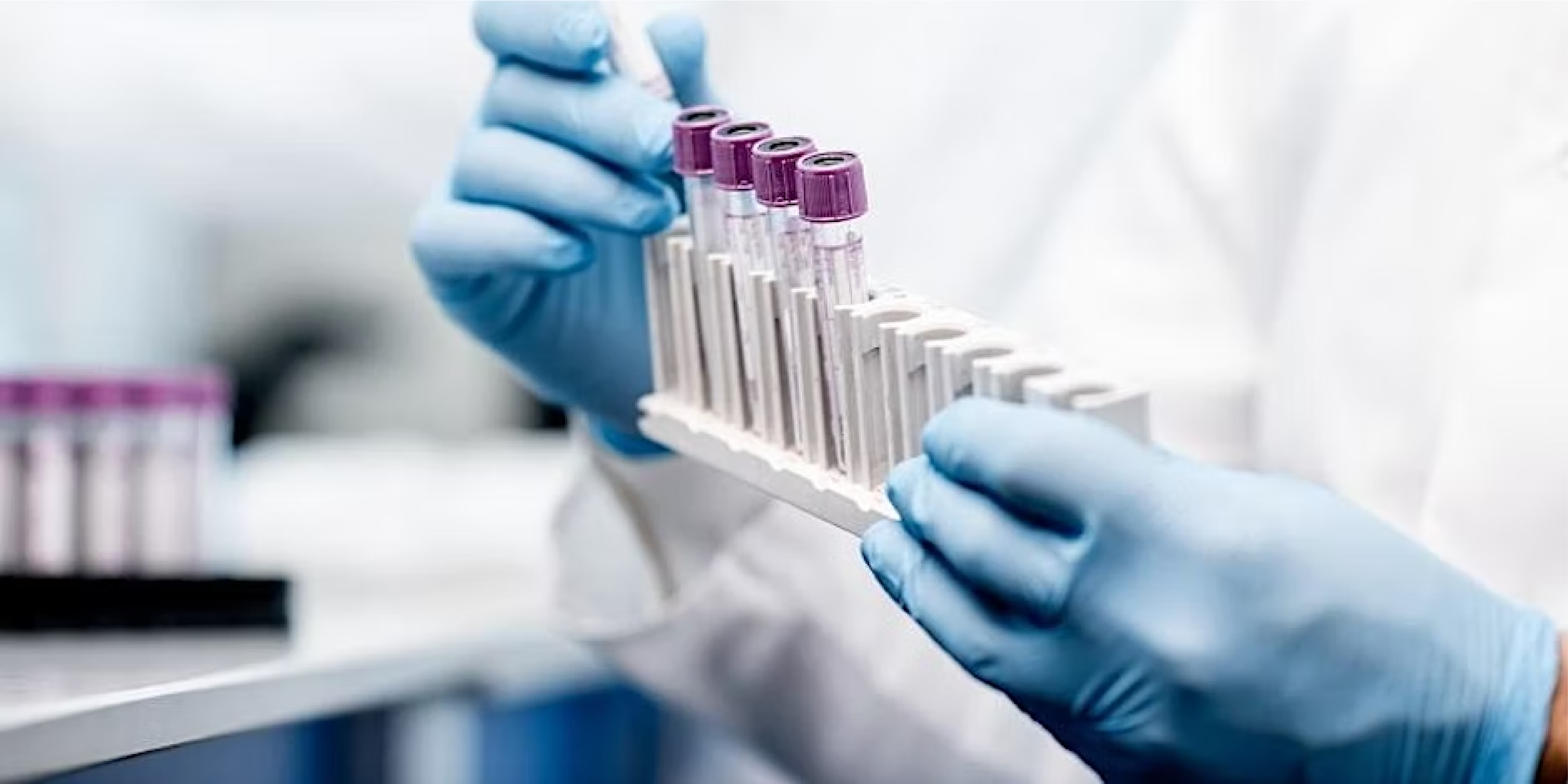 HORIBA - Developments in Biopharma processes using Optical Spectroscopy