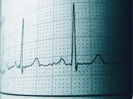 Visuel d'un graphique illustrant la cohérence cardiaque