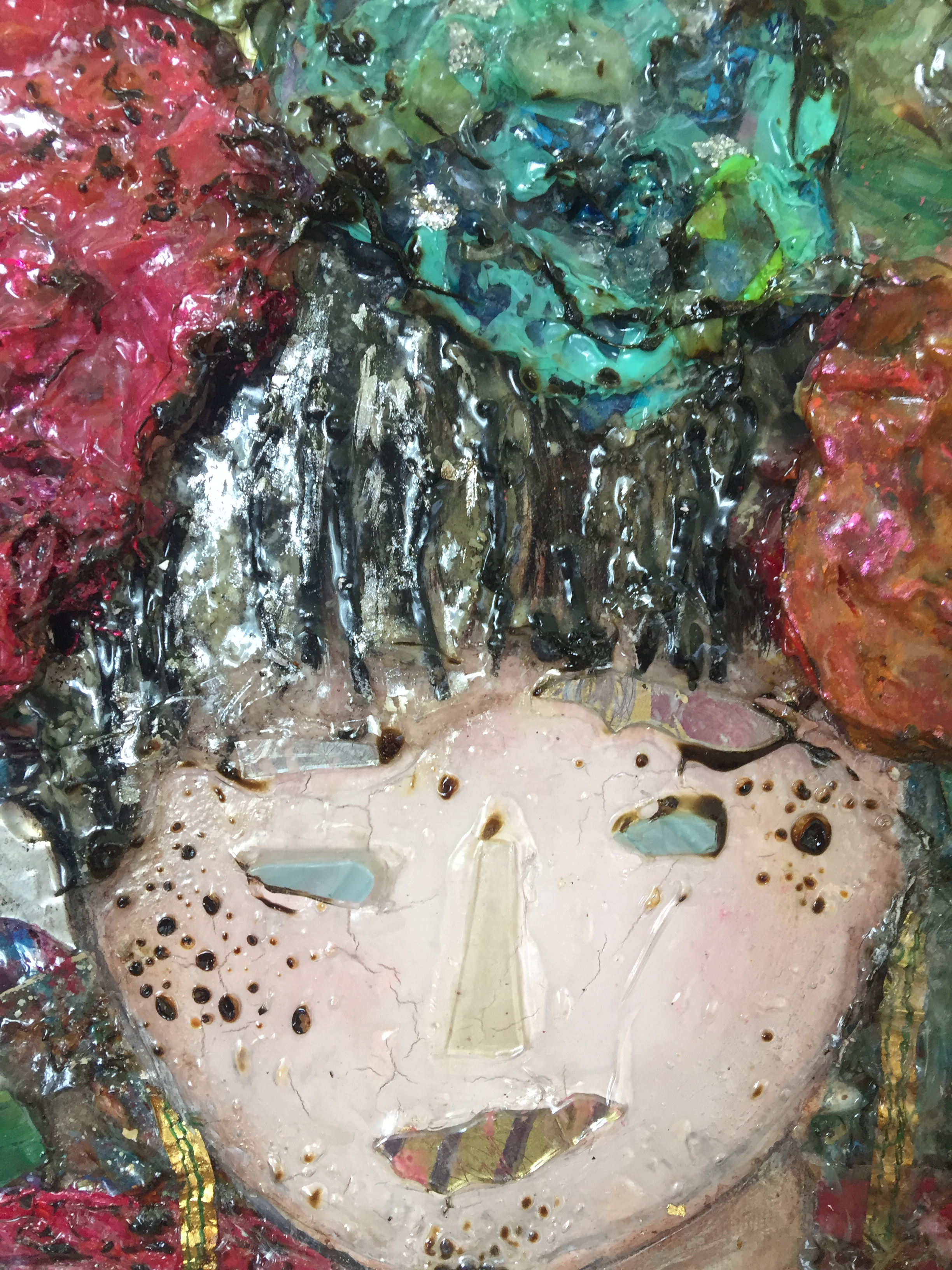  "Burn Victim" (detail)  