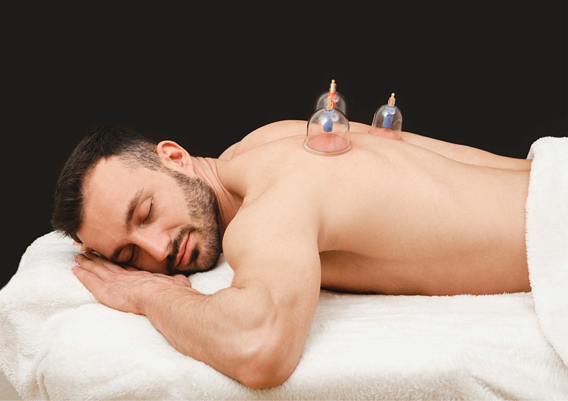 🌿 Cupping Therapy Explained: How It Works and Who It Helps