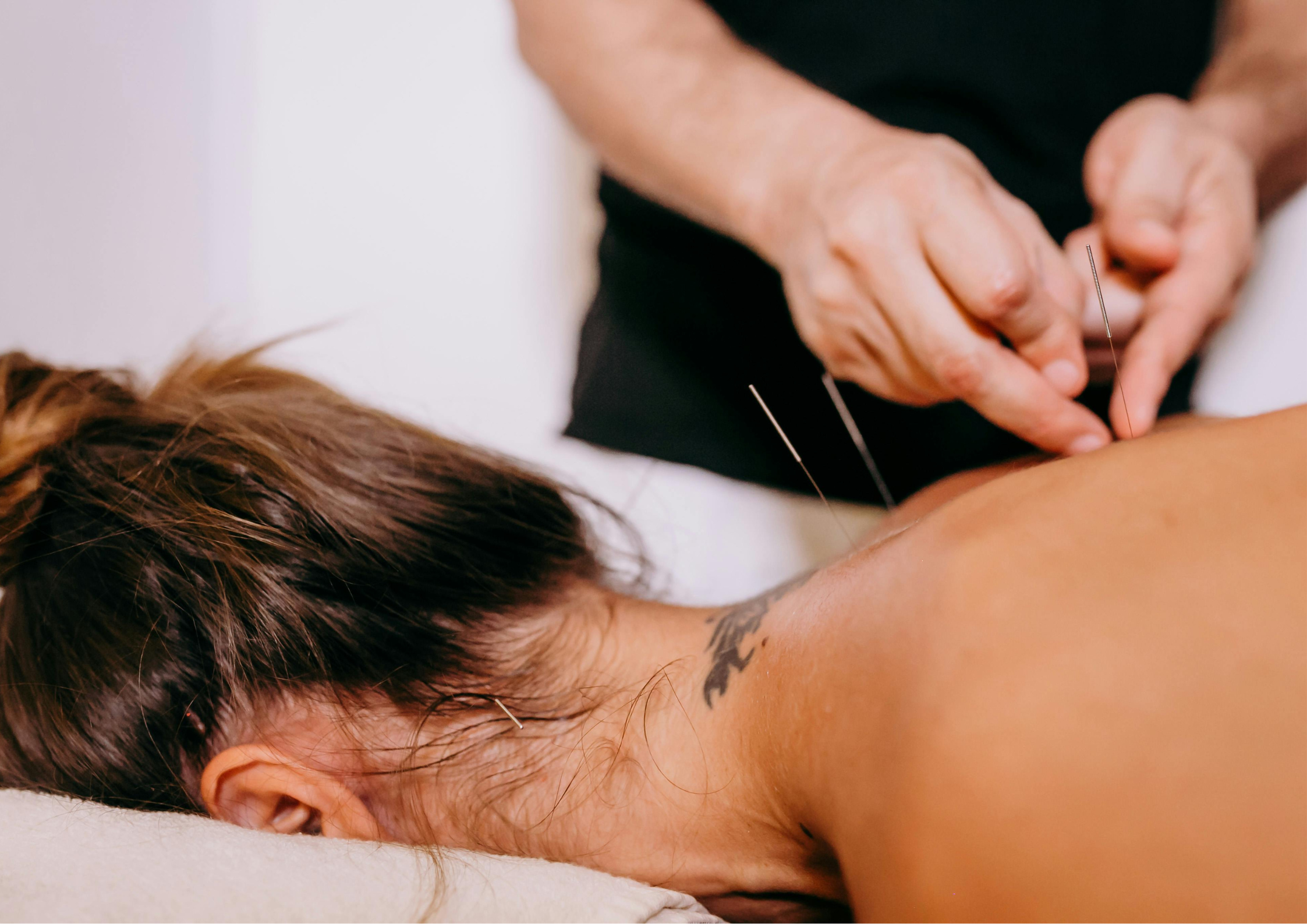  How Does Acupuncture Work?
