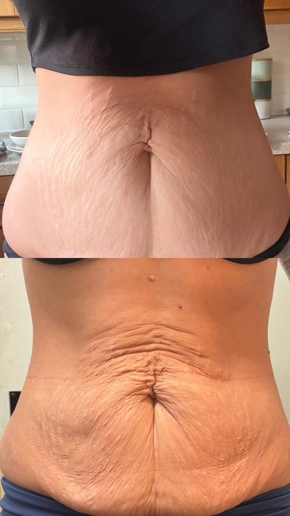 Million Dollar Body Treatments