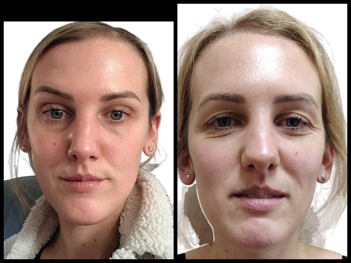 Product Results - i-Tx