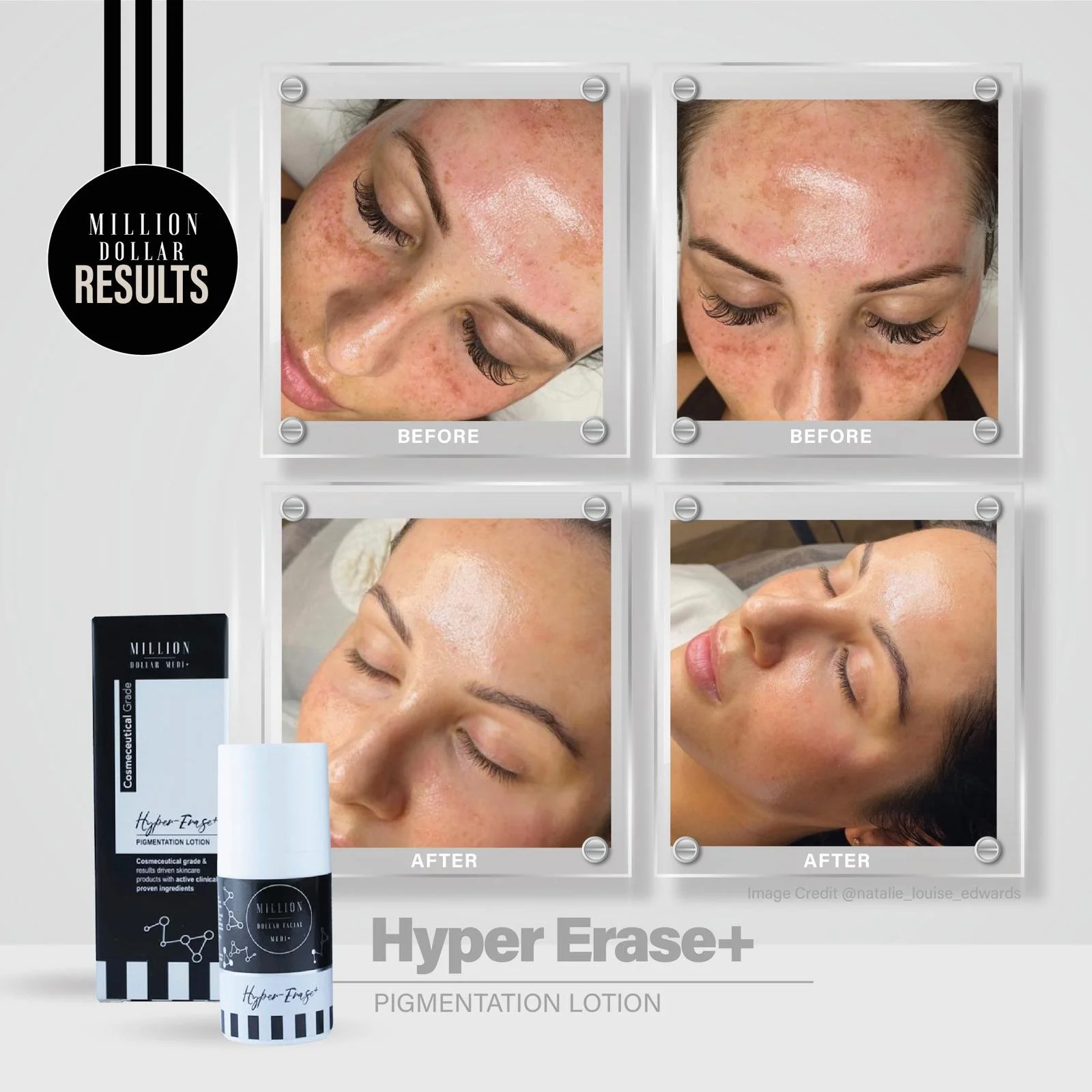 H.Erase Results 1.jpeg