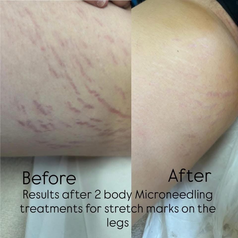 Million Dollar Body Treatments