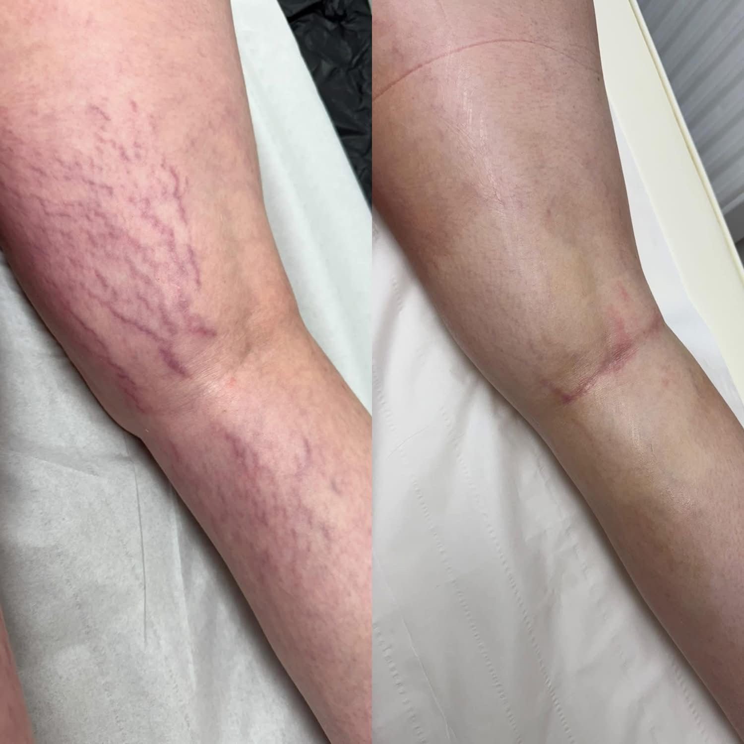 Million Dollar Body Treatments