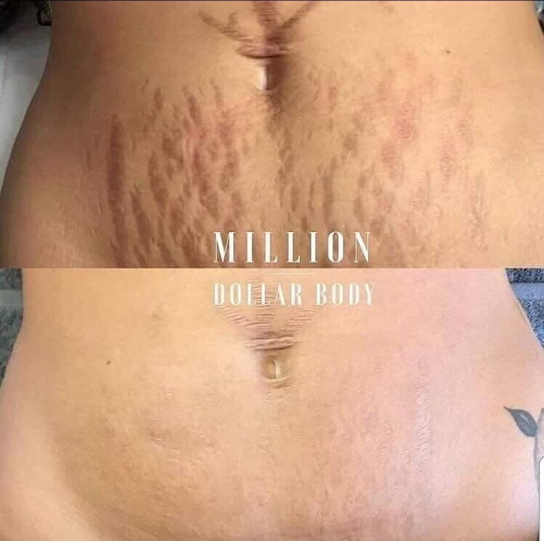 Million Dollar Body Treatments