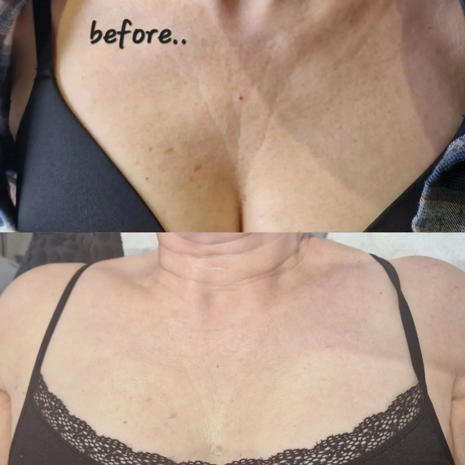 Million Dollar Body Treatments