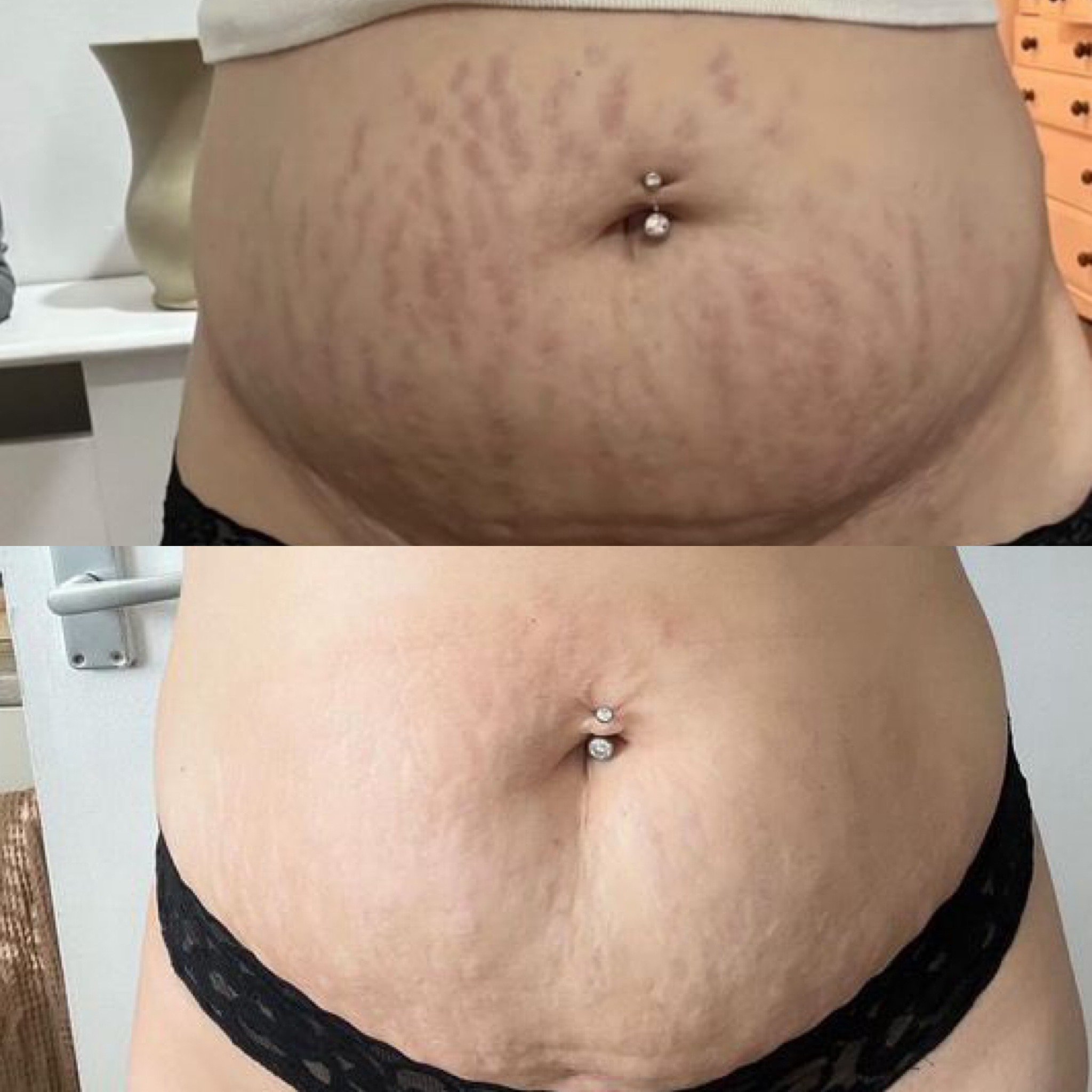 Million Dollar Body Treatments