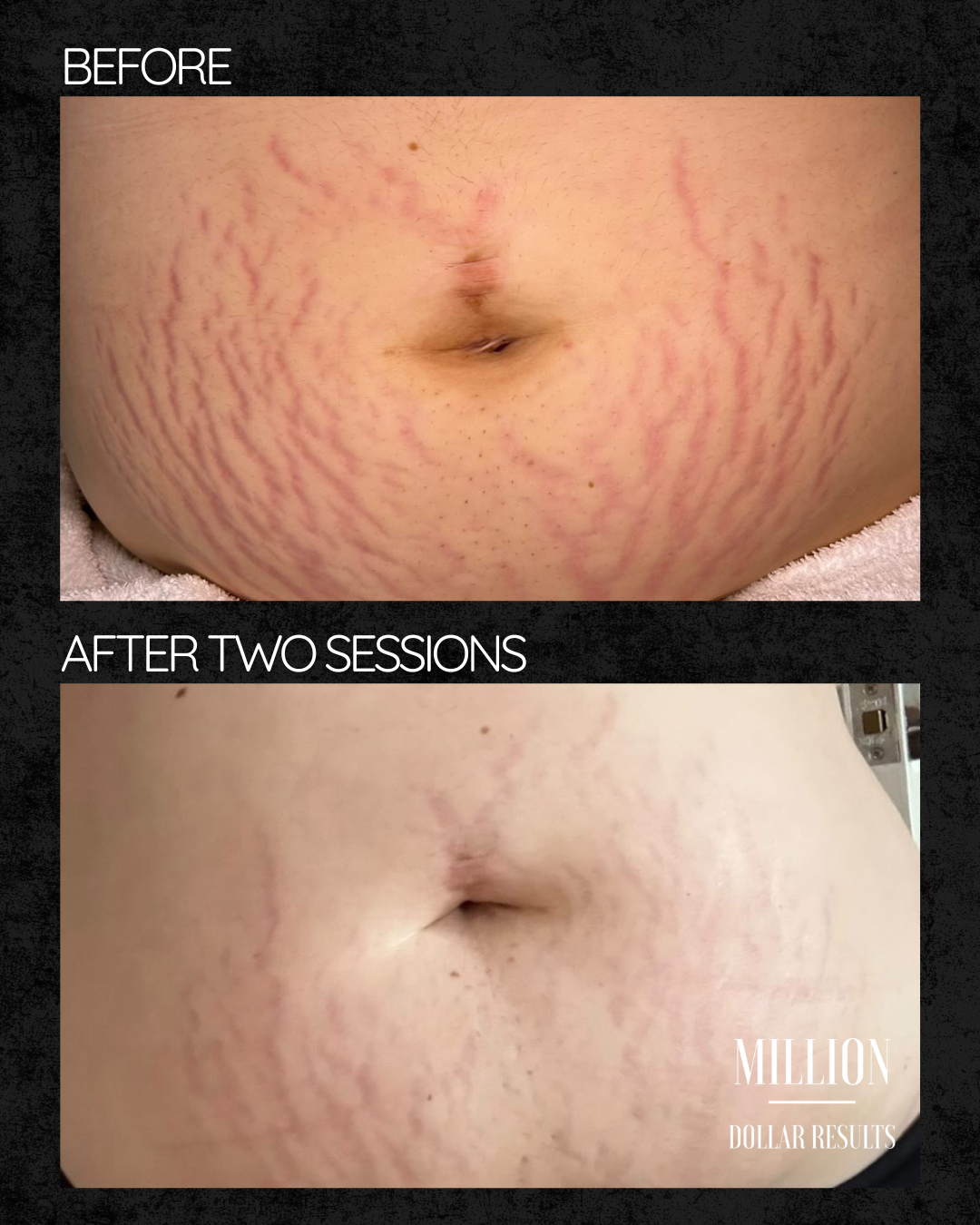 Million Dollar Body Treatments