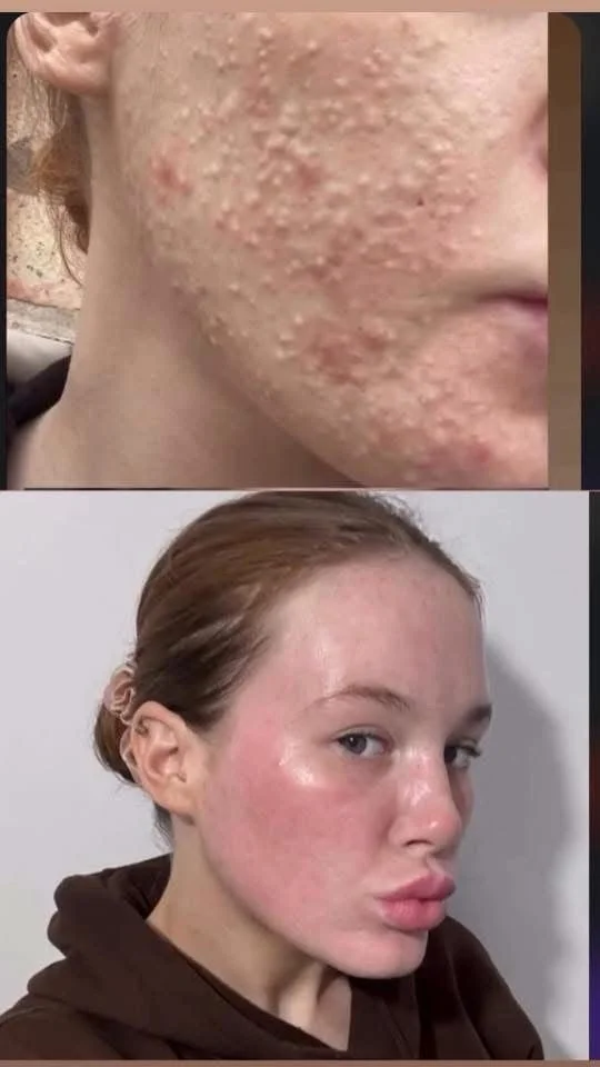 Million Dollar Facial Treatments