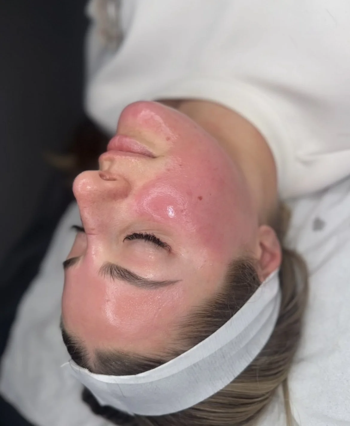 Million Dollar Facial Treatments