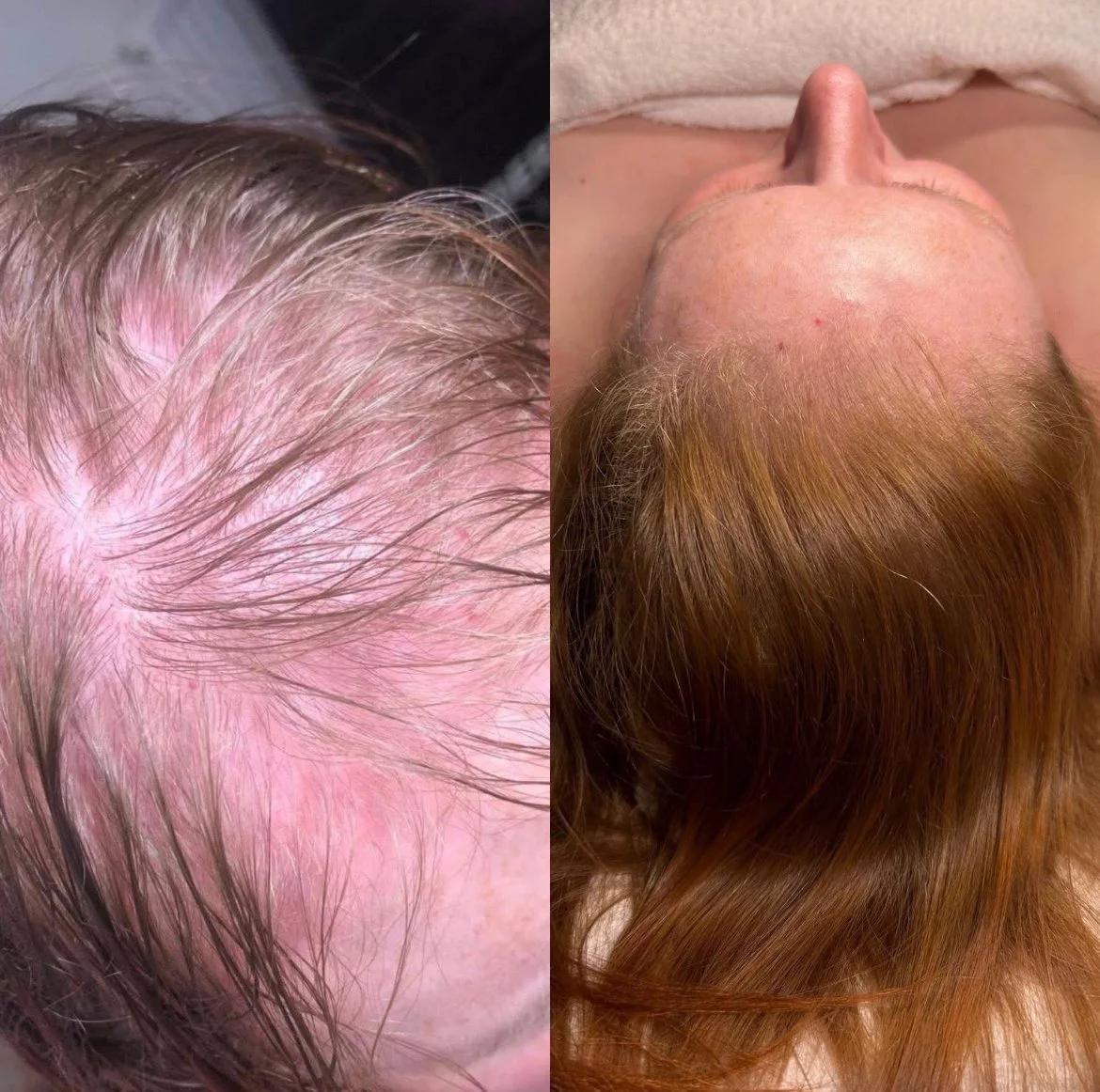 Million Dollar Hair Treatment