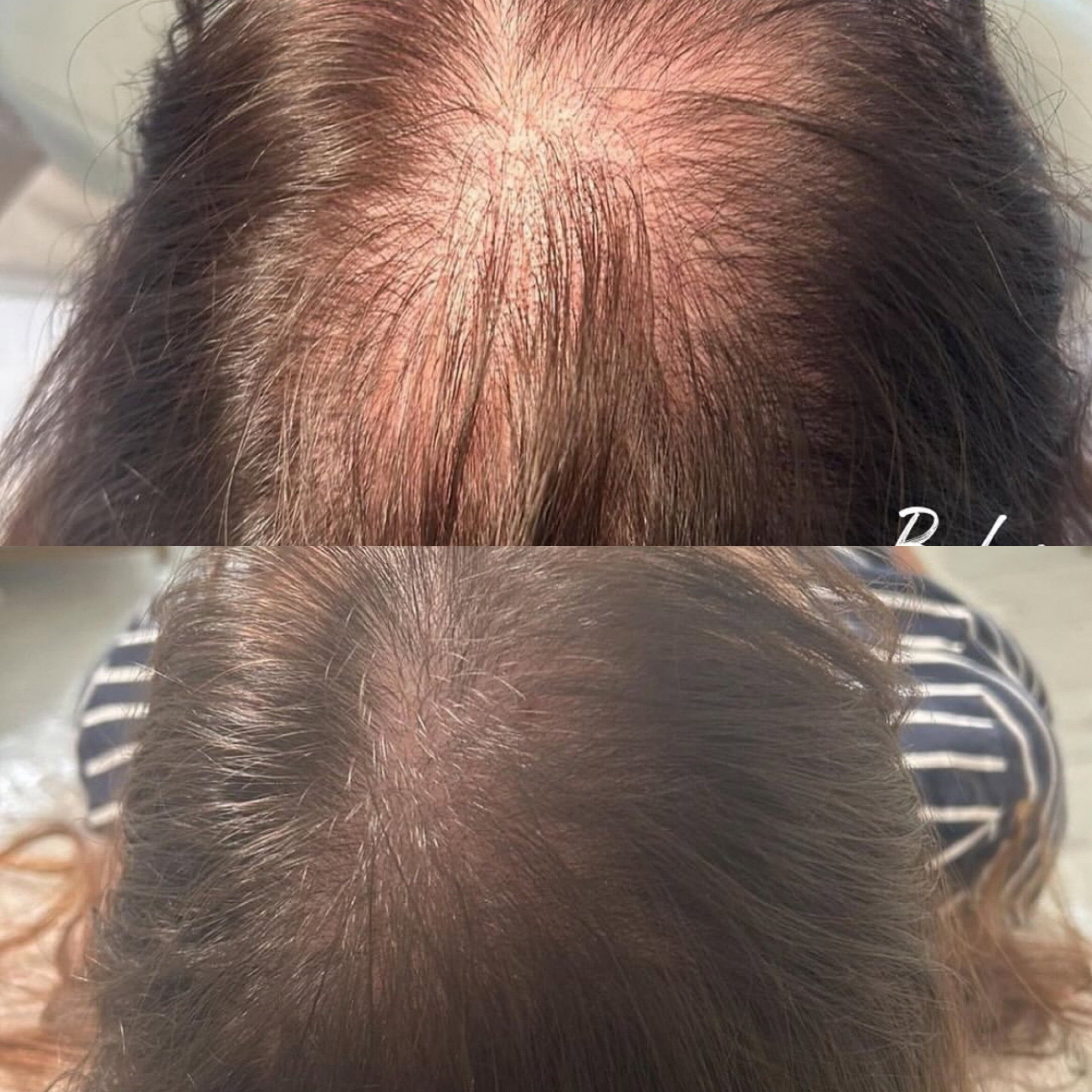 Million Dollar Hair Treatment