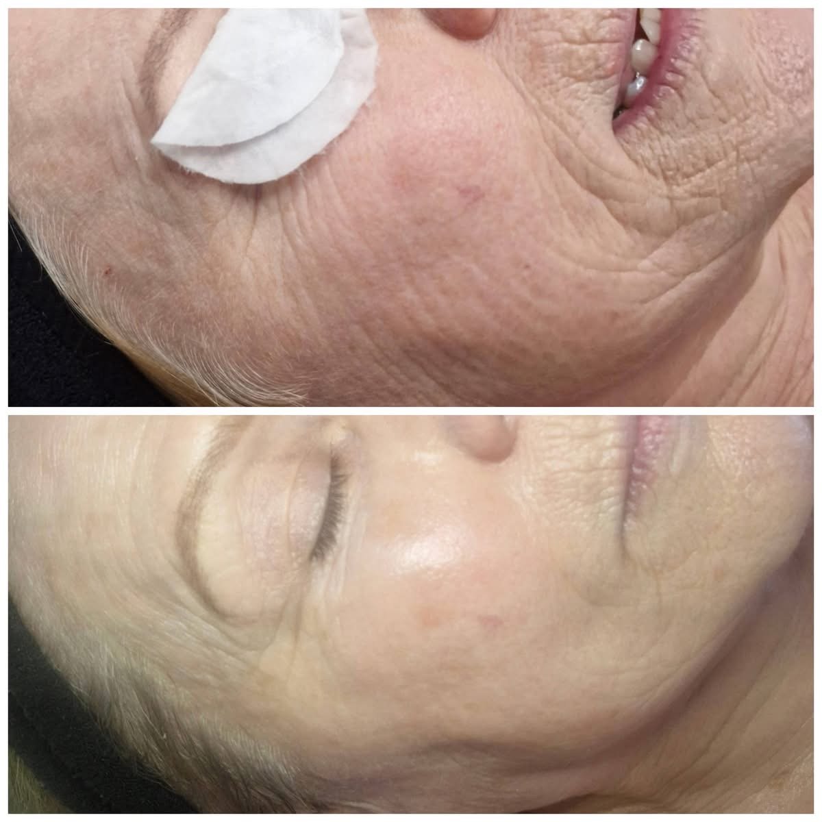 Product Results - Retinight