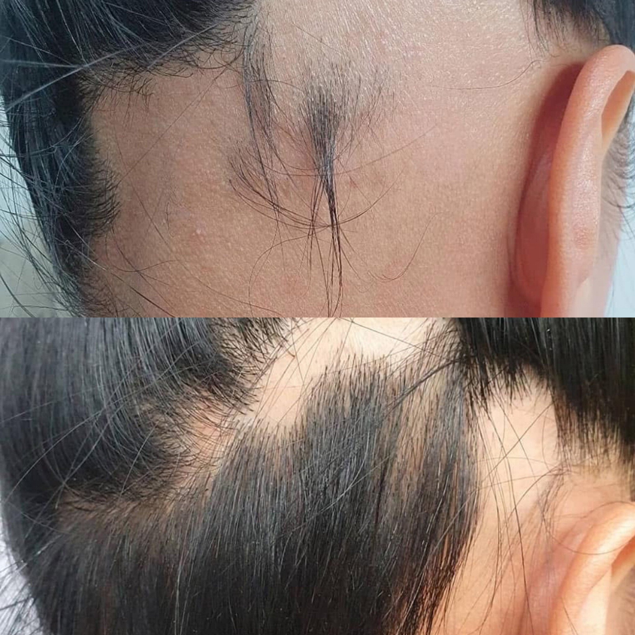 Million Dollar Hair Treatment