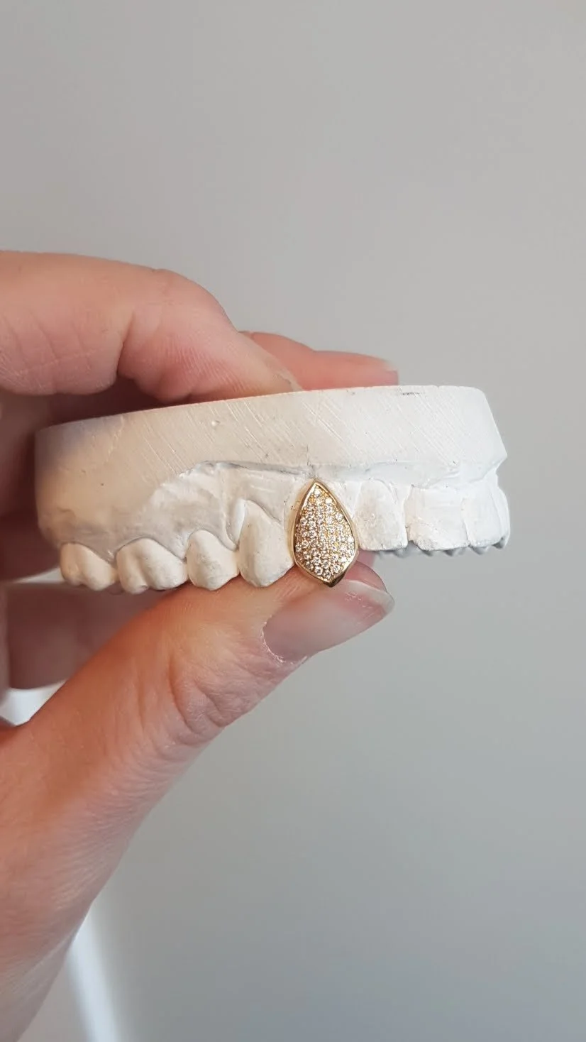 18K yellow gold pave set diamond removable tooth cap/grill