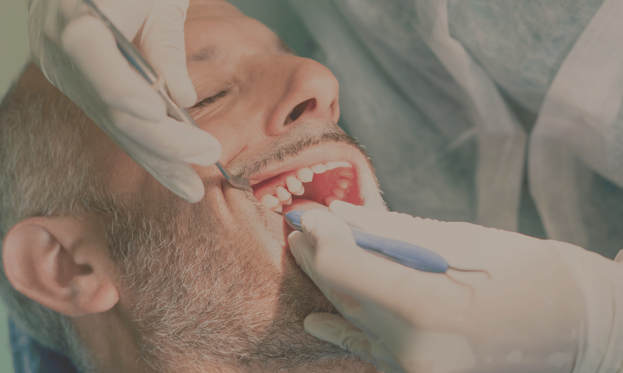 Scale and Polish vs Deep Cleaning: What's the Real Difference?