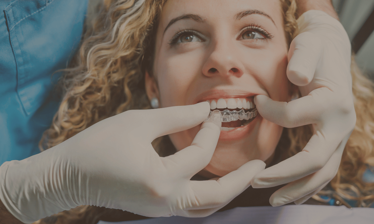 How Long Does Invisalign Treatment Take?