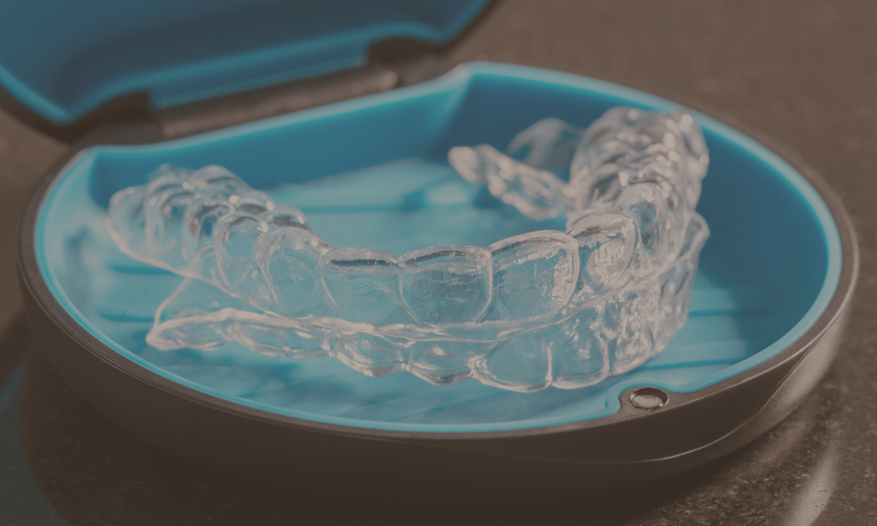 Do You Need to Wear a Retainer Forever After Invisalign?