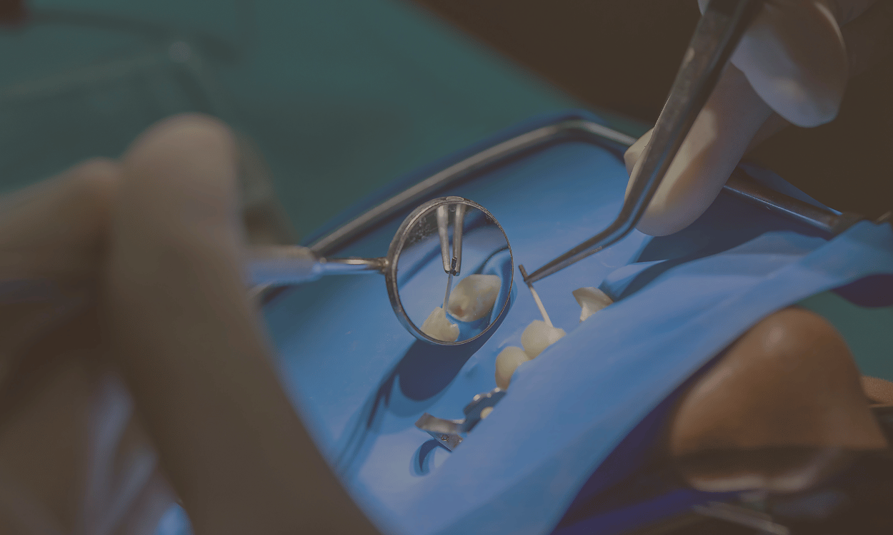 Are Root Canals Really Painful? Busting the Biggest Myth